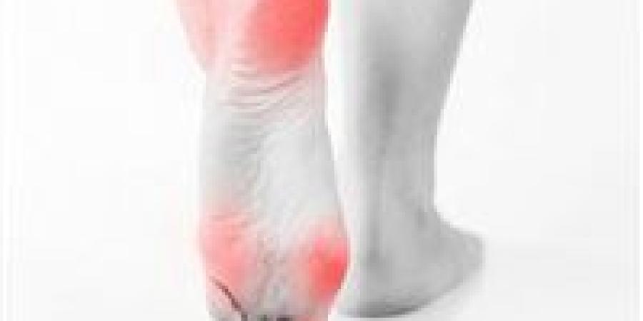 ثقل الساقين في الصيف.. الأسباب وطرق الوقاية والعلاج - كورة نيوز